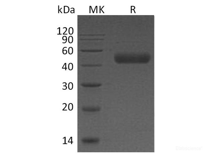 Recombinant Human Galectin 9 Protein(C-6His)-Elabscience