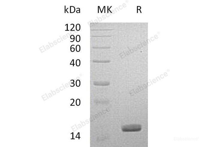 Recombinant Human Galectin-14/LGALS14 Protein(C-6His)-Elabscience