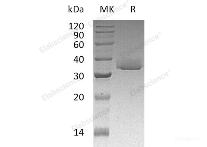 Recombinant Human Galectin-3/LGALS3 Protein(C-6His, Cells)-Elabscience