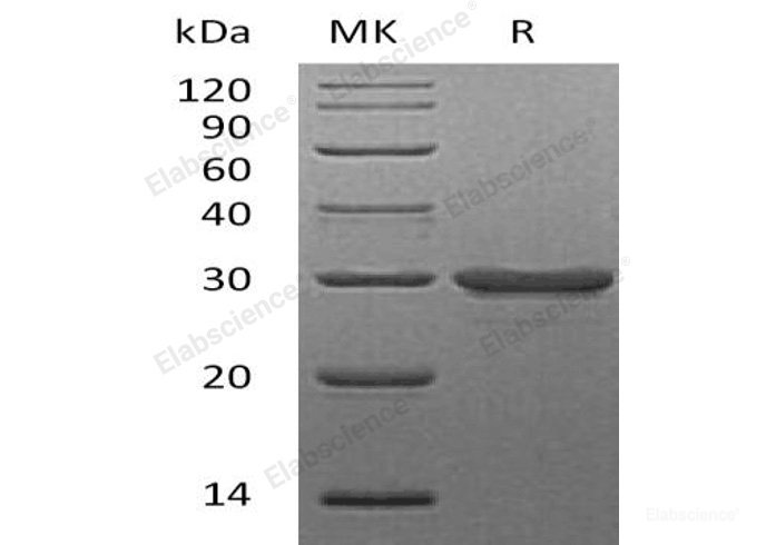 Recombinant Human Galectin-3/LGALS3 Protein-Elabscience