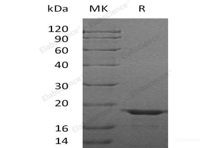 Recombinant Human Galectin-Related Protein/LGALSL Protein(C-6His)-Elabscience