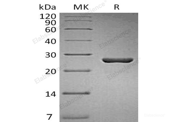 Recombinant Human Gankyrin/PSDM10 Protein-Elabscience