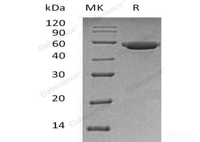 Recombinant Human Gastric Triacylglycerol Lipase/LIPF Protein(C-6His)-Elabscience