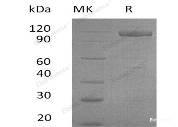 Recombinant Human GDNF Receptor α-2/GFRA2 Protein(C-Fc-6His)-Elabscience
