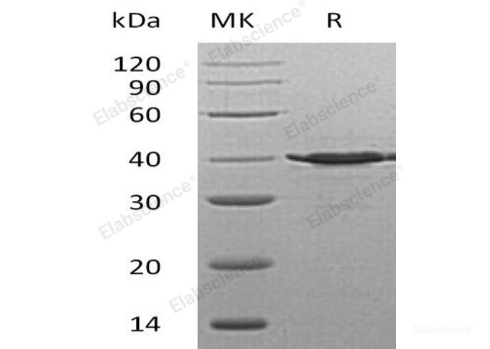 Recombinant Human GDP-L-Fucose Synthase/TSTA3/SDR4E1 Protein(C-6His)-Elabscience