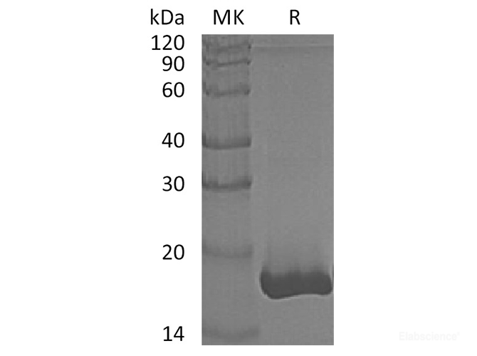 Recombinant Human Glia Maturation Factor β/GMF-β/GMFB Protein(C-6His)-Elabscience