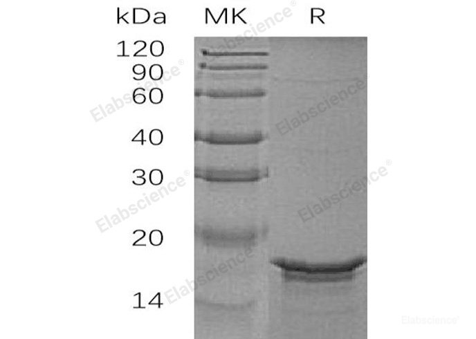 Recombinant Human Glial Fibrillary Acidic Protein/GFAP Protein(N-6His)-Elabscience