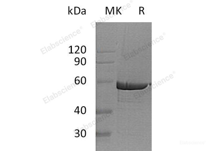 Recombinant Human Glucose-6-Phosphate 1-Dehydrogenase/G6PD Protein(C-6His)-Elabscience