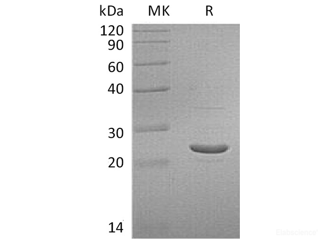 Recombinant Human Glutathione S-transferase P/GSTP1 Protein-Elabscience