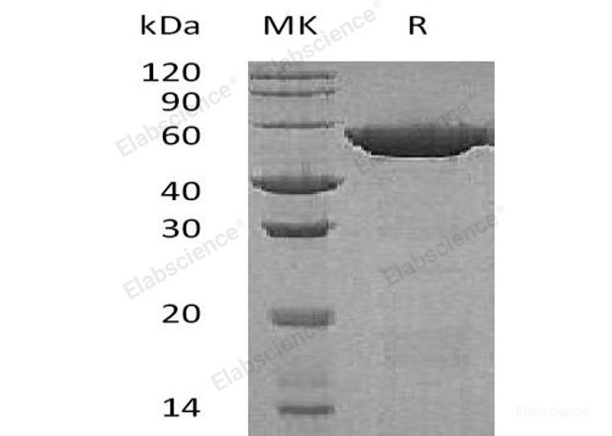 Recombinant Human Glutathione Synthetase/GSH Synthetase Protein(C-6His)-Elabscience