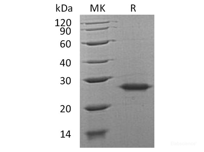 Recombinant Human Grancalcin/GCA Protein-Elabscience