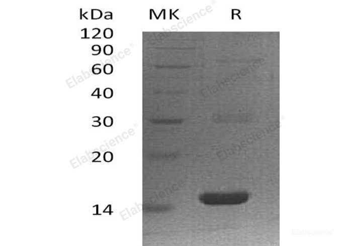 Recombinant Human Group XVI Phospholipase A1/A2/PLA2G16 Protein(N-6His)-Elabscience