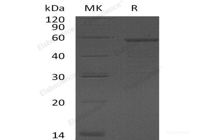 Recombinant Human Growth Arrest-Specific Protein 7/GAS-7/KIAA0394 Protein(N-6His)-Elabscience