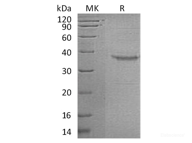 Recombinant Human Growth Hormone-Releasing Factor/GHRF/Somatoliberin Protein(C-Fc)-Elabscience