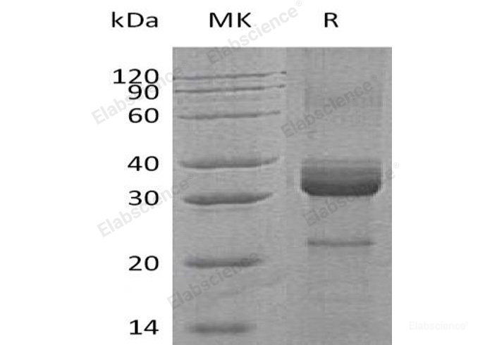 Recombinant Human Haptoglobin/Zonulin Protein(N-6His)-Elabscience