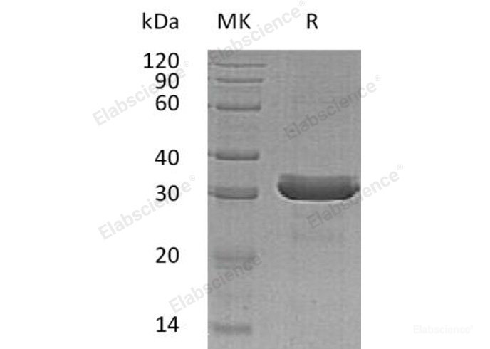 Recombinant Human HDGFRP3/HRP-3/HDGF2 Protein(C-6His)-Elabscience