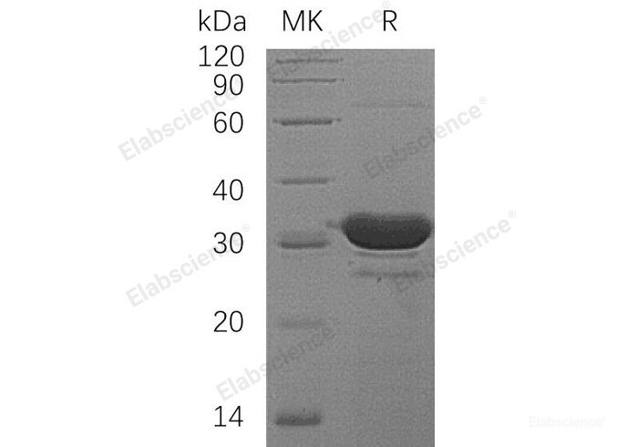 Recombinant Human HDHD2 Protein(N-6His)-Elabscience