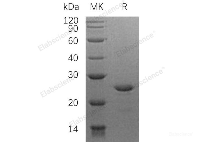 Recombinant Human Heat Shock Factor Protein 2/HSF2 Protein(N-6His)-Elabscience