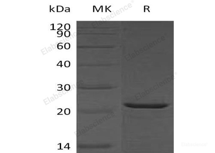 Recombinant Human Heat Shock Protein β-2//HSPB2/MKBP Protein(C-6His)-Elabscience