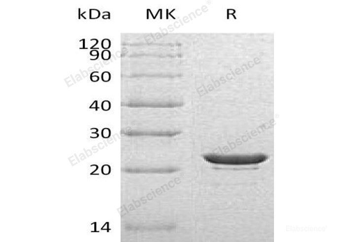 Recombinant Human Heat Shock Protein β-8//HSPB8 Protein(C-6His)-Elabscience
