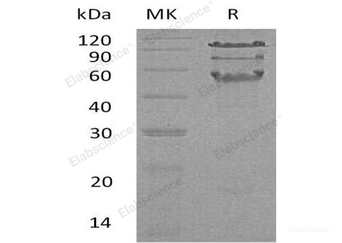 Recombinant Human Hematopoietic Lineage Cell-Specific Protein/HCLS1 Protein(C-6His)-Elabscience