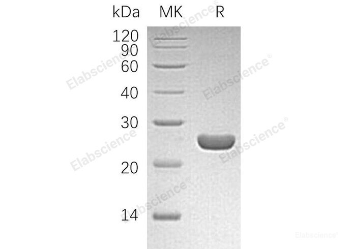 Recombinant Human Hematopoietic Prostaglandin D Synthase/HPGDS/GSTS Protein-Elabscience