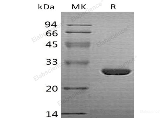 Recombinant Human Heme Oxygenase 1/HO-1 Protein-Elabscience