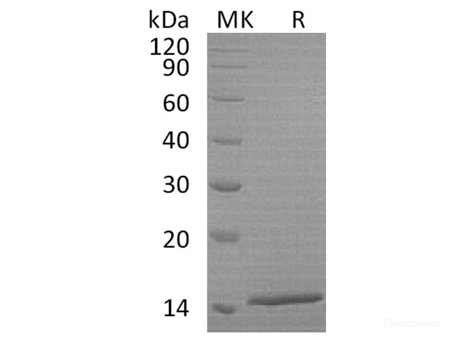 Recombinant Human Hemoglobin Subunit α/HBA1 Protein(N-6His)-Elabscience