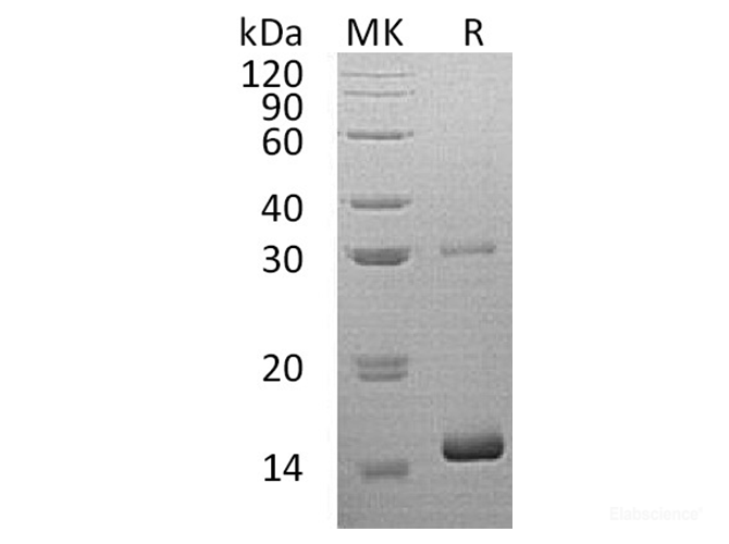 Recombinant Human Hemoglobin Subunit θ-1/HBQ1 Protein(N-6His)-Elabscience