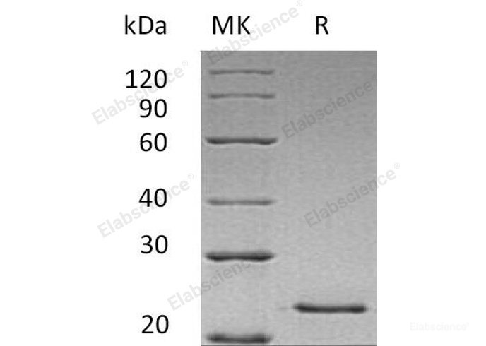 Recombinant Human Hepatocyte Growth Factor/HGF/Hepatopoietin-A Protein(C-6His)-Elabscience