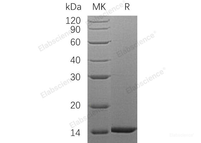 Recombinant Human Hepatoma-Derived Growth Factor/HDGF Protein(C-6His)-Elabscience