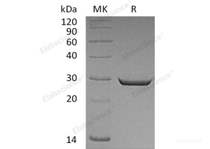 Recombinant Human High Mobility Group Protein B2/HMGB2 Protein(C-6His)-Elabscience