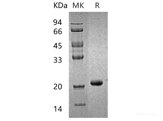 Recombinant Human Hippocalcin-Like Protein 1/HPCAL1 Protein(N-6His)-Elabscience