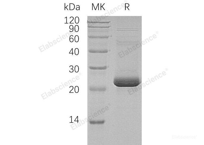Recombinant Human Histone Chaperone ASF1A/ASF1A Protein(C-6His, N-T7 tag)-Elabscience