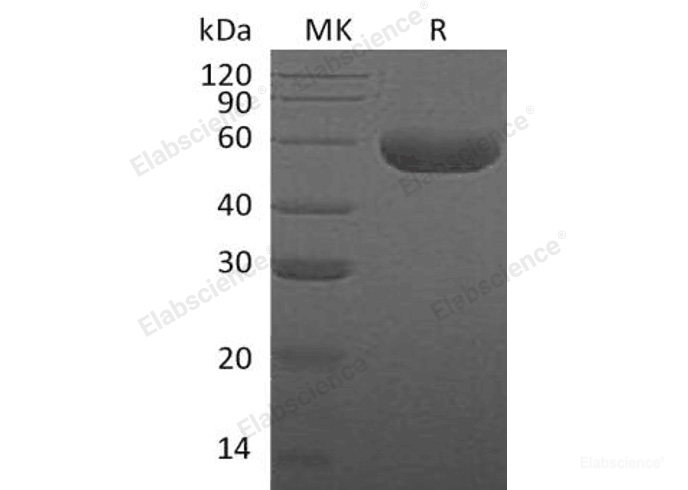 Recombinant Human Hyaluronidase-1/HYAL1 Protein(C-6His)-Elabscience