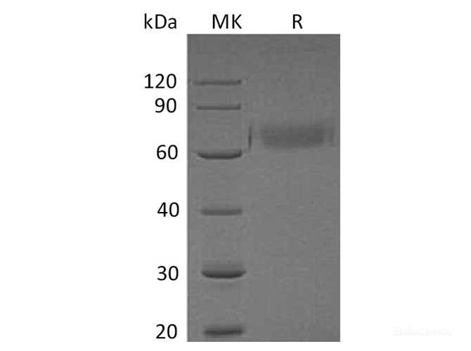 Recombinant Human Hypoxia up-Regulated Protein 1/HYOU1 Protein(C-10His)-Elabscience
