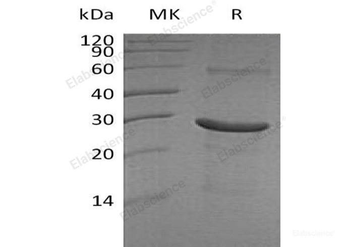 Recombinant Human IA2/PTPRN Protein(Gln607-Asn686 & Trp795-Leu888, N-6His)-Elabscience