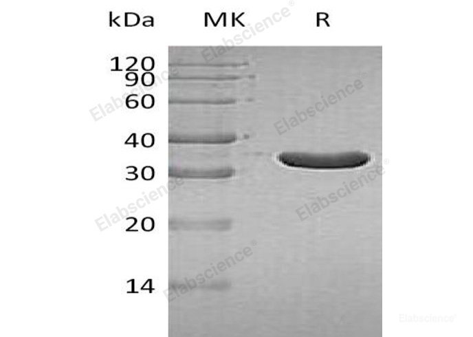 Recombinant Human IA2/PTPRN Protein(Met687-Gln979, N-6His)-Elabscience