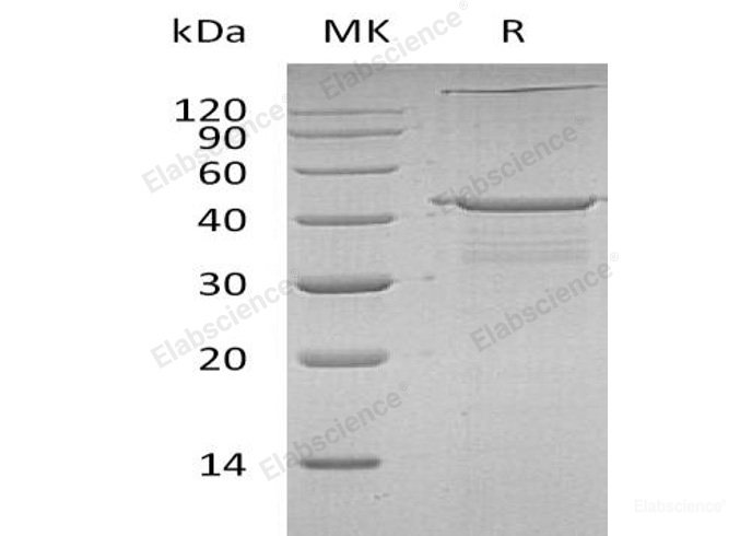 Recombinant Human IGF2 mRNA-Binding Protein 2/IGF2BP2/IMP2 Protein(C-6His, N-T7 tag)-Elabscience