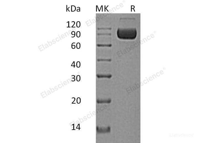 Recombinant Human IL-1 Receptor Accessory Protein/IL-1RAcP/IL-1R3 Protein(C-Fc-6His)-Elabscience