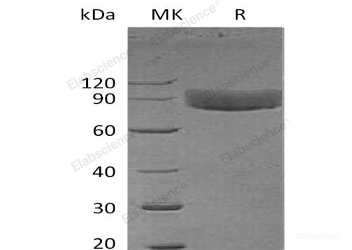 Recombinant Human IL-1 Receptor Type 1/IL-1R-1 Protein(C-Fc)-Elabscience