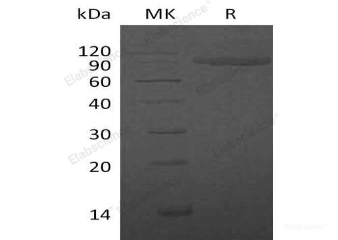 Recombinant Human IL-1 Receptor Type 2/IL-1R-2 Protein(C-Fc)-Elabscience