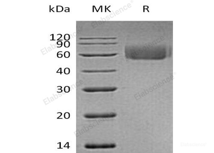 Recombinant Human IL-1 Receptor-Like 2/IL-1RL2 Protein(C-6His)-Elabscience