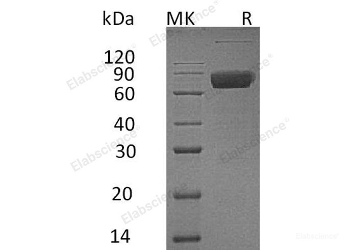 Recombinant Human IL-10 Receptor Subunit β/IL-10RB Protein(C-Fc)-Elabscience