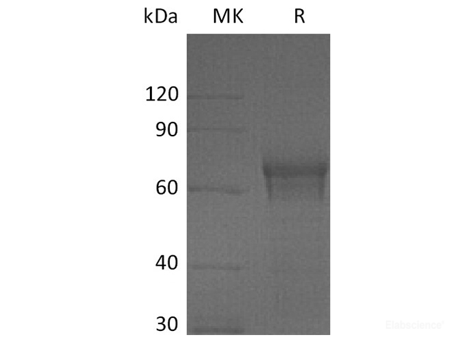 Recombinant Human IL-15 Receptor Subunit α/IL-15RA/CD215 Protein(C-Fc)-Elabscience