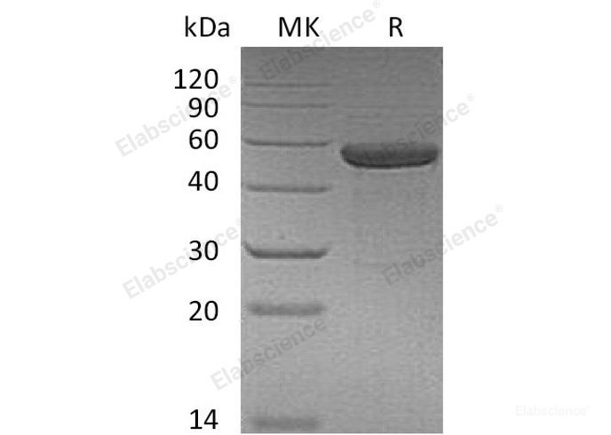Recombinant Human IL-15 Receptor α & IL-15 Fusion Protein/IL15RA&IL15 Protein(C-Fc)-Elabscience