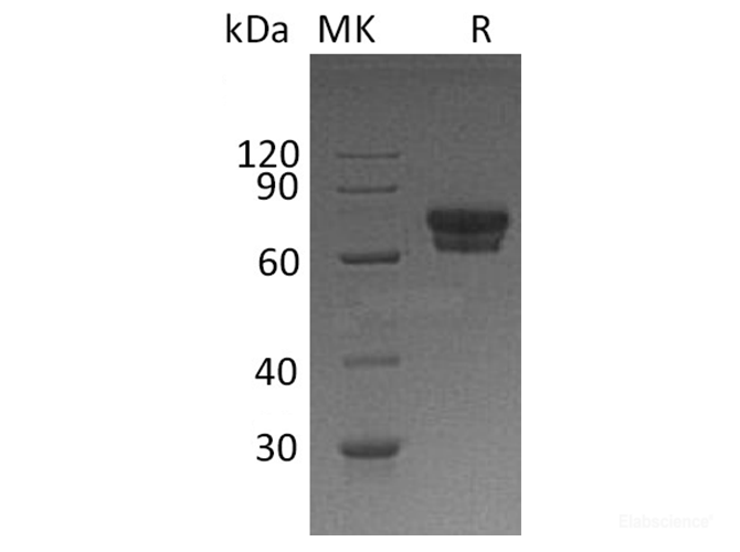 Recombinant Human IL-2 Receptor Subunit α/IL-2RA/CD25 Protein(C-Fc)-Elabscience