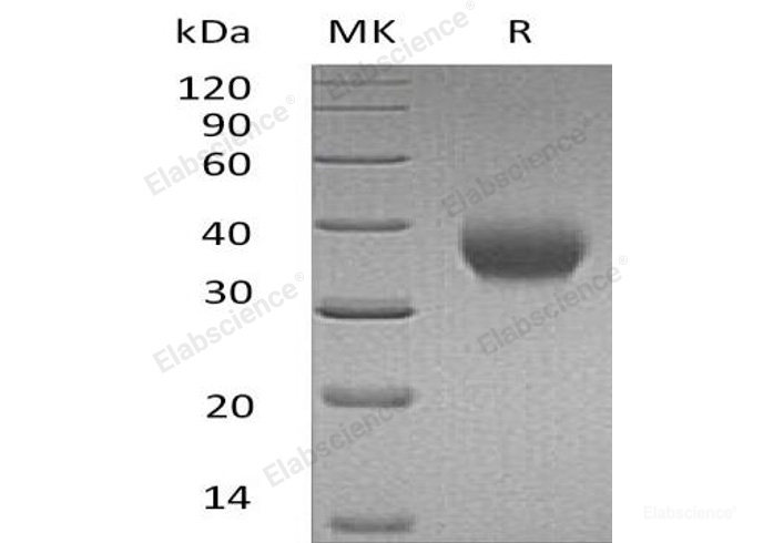 Recombinant Human IL-2 Receptor Subunit β/IL-2RB/CD122 Protein(C-6His)-Elabscience