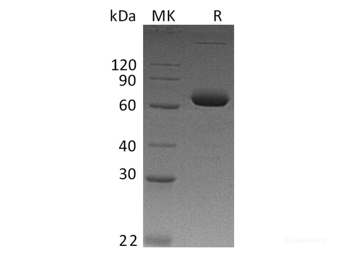 Recombinant Human IL-2 Receptor Subunit β/IL-2RB/CD122 Protein(C-Fc)-Elabscience
