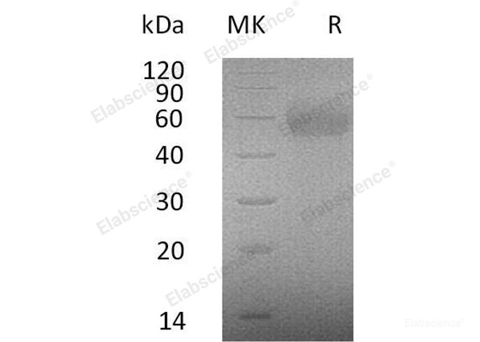 Recombinant Human IL-2 Receptor Subunit γ/IL-2RG/CD132 Protein(C-Fc-6His)-Elabscience